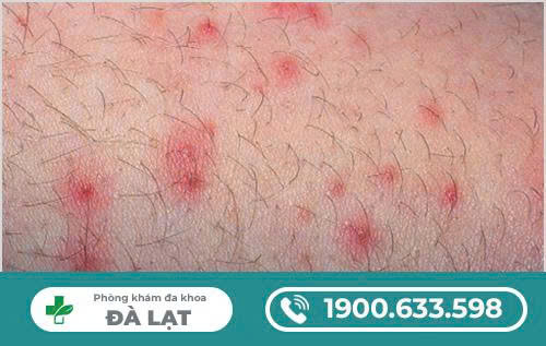 Hình ảnh minh họa